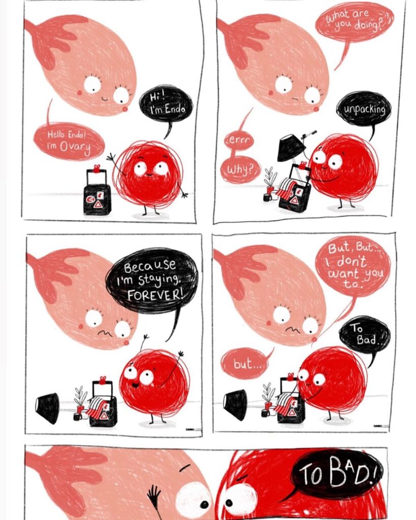 ენდომეტრიოზი